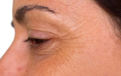 What You Need To Know About Facials For Crow’s Feet
