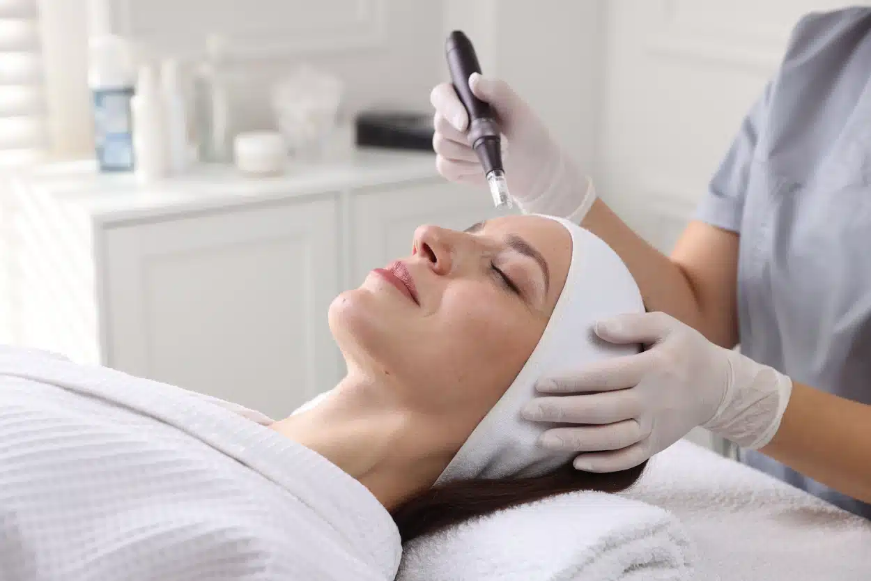 micro-needling_greentoes photo of a woman getting micro-needling