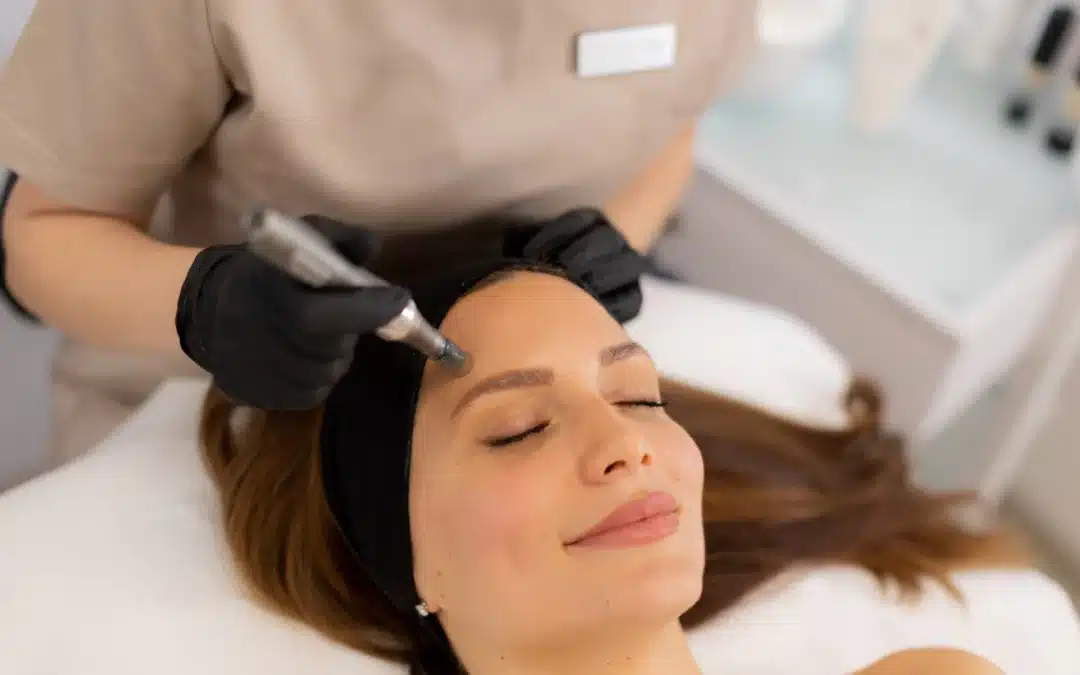 Microneedling Aftercare: How to Heal Faster & Protect Results