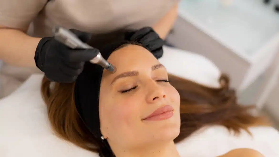 microneedling_tucson 16x9 photo of a woman getting microneedling